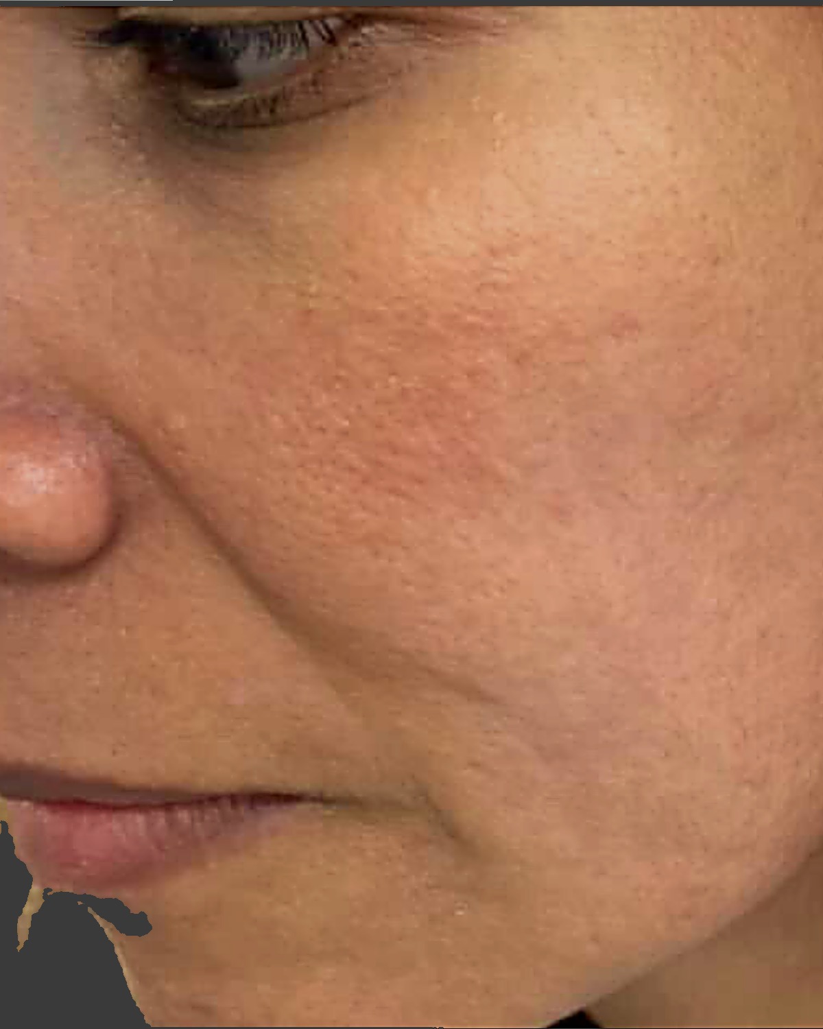 After treatment