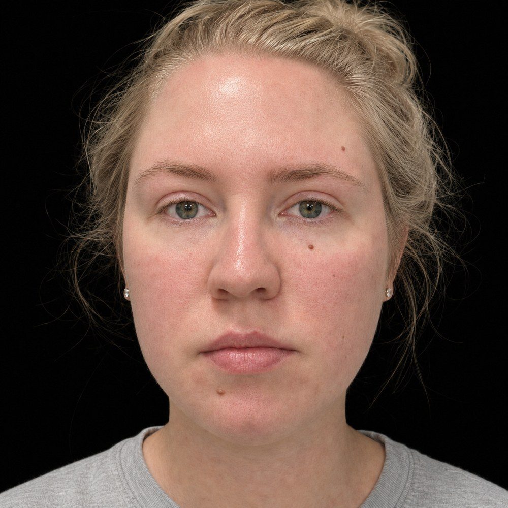 After treatment