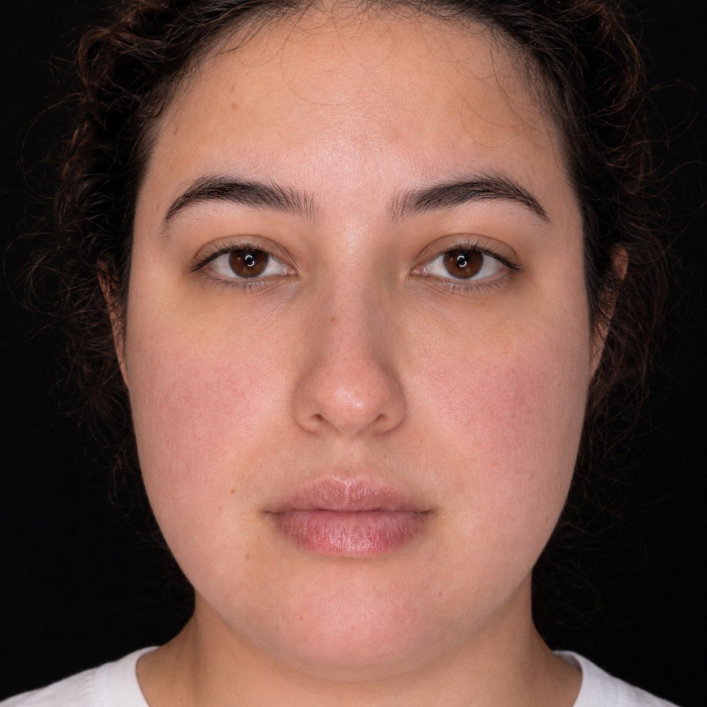 After treatment