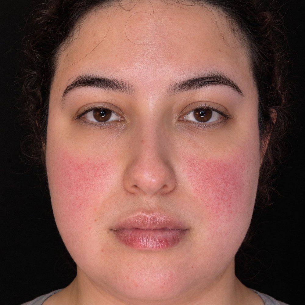 Before treatment