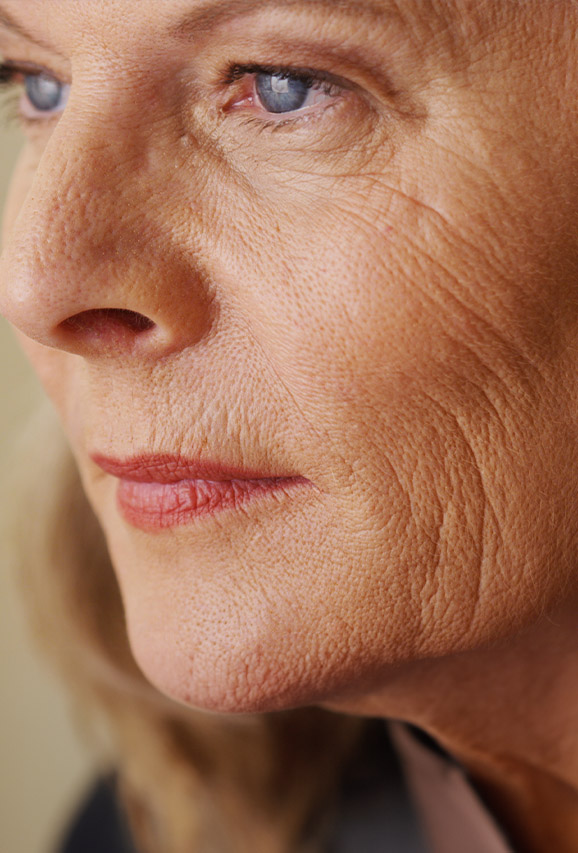 Wrinkles
