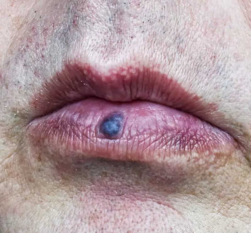 Lumps, bumps & miscellaneous