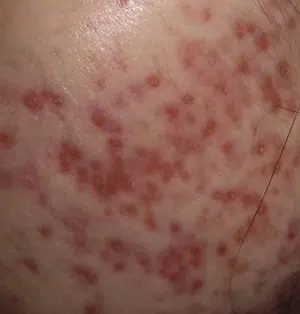 Red marks
