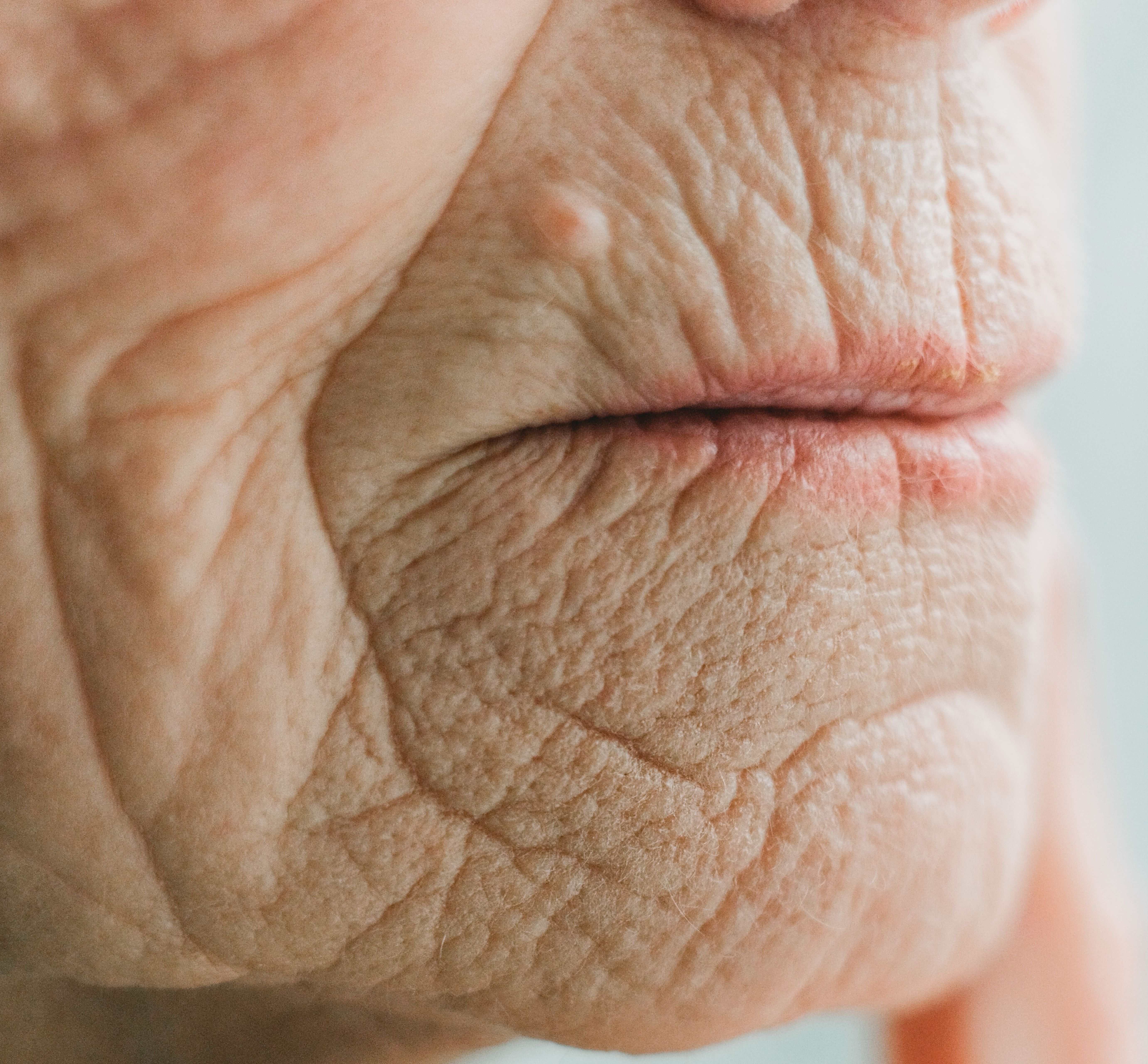 Skin rejuvenation